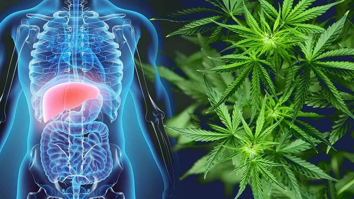 CBD Help in Liver Disease